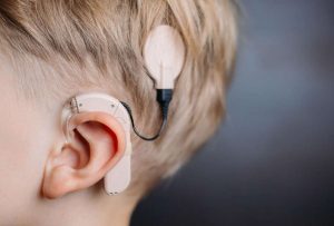 El Ministerio de Salud inicia jornadas de implantes cocleares