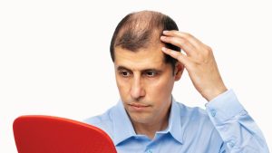 Efectos secundarios de la Finasterida, el medicamento para prevenir la caída del cabello