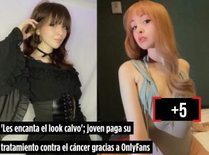 Les encanta el look calvo’; joven paga su tratamiento contra el cáncer gracias a OnlyFans