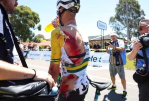 El ciclista australiano Luke Plapp sufrió una fuerte caída