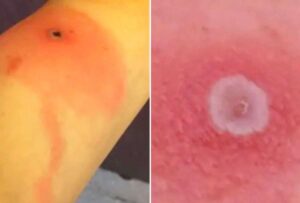 Se registró la primera muerte causada por Alaskapox