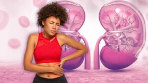 Cuál es la fruta que ayuda a eliminar las piedras en los riñones