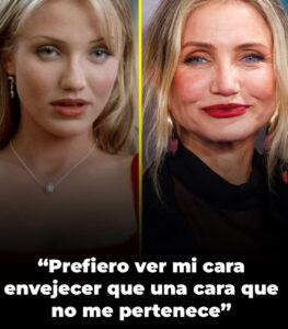 La actriz prefiere envejecer naturalmente