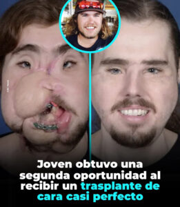 Máscara facial impresa en 3D