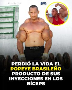 Falleció Arlindo de Souza, conocido como el “Popeye brasileño”