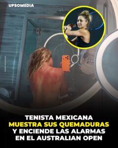 Renata Zarazúa encendió las alarmas antes del Australian Open 2026, al mostrar en redes sociales su espalda quemada por el sol