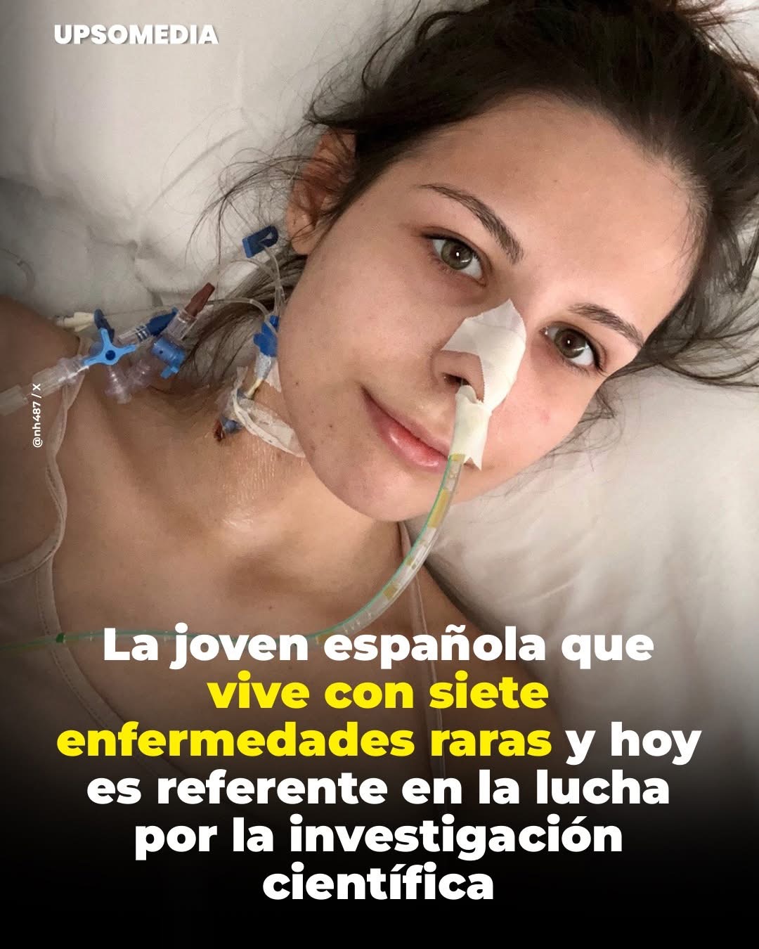 Convive con siete enfermedades raras que han marcado su vida desde la infancia