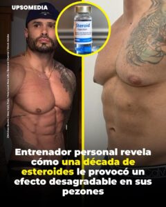 Con el tiempo el uso constante alteró su equilibrio hormonal y desarrolló ginecomastia