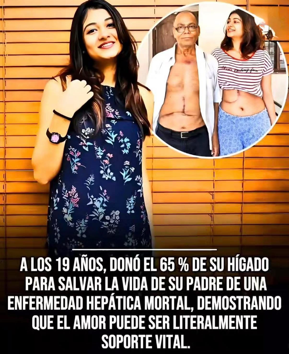 Decidió donar el 65% de su propio hígado