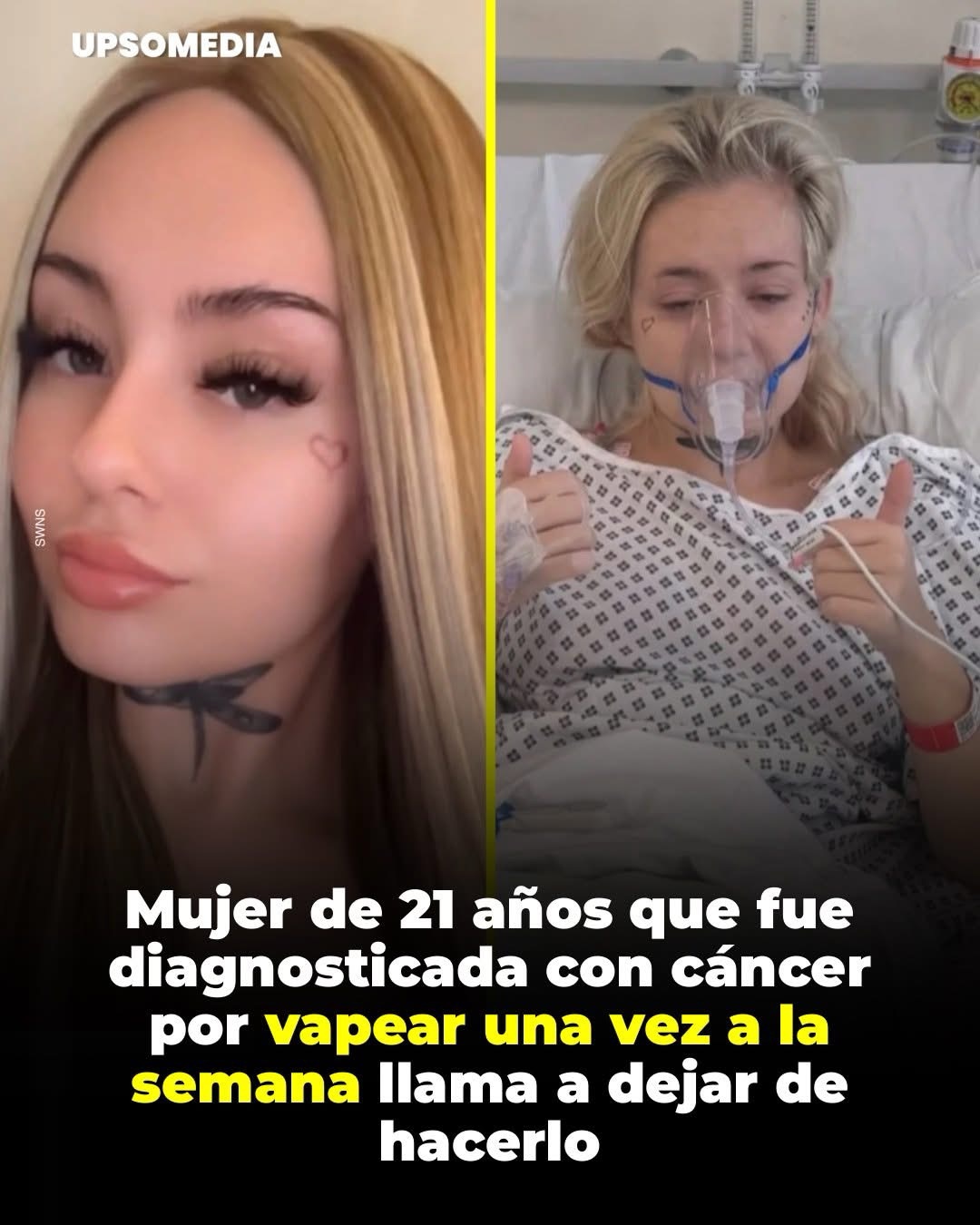 Kaley Bosa, con solo 21 años, recibió un diagnóstico que muchos asocian al tabaquismo crónico.