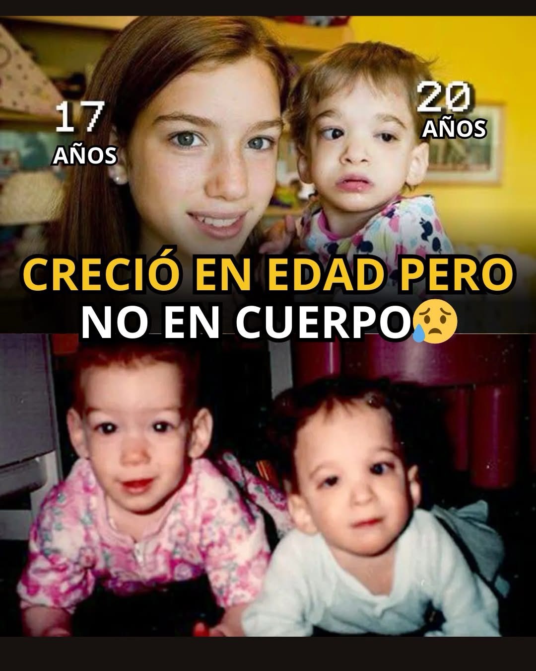 😱EL MISTERIO MÉDICO DEL “SÍNDROME X”