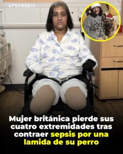 Manjit Sangha, una británica de 56 años, sufrió la amputación de sus cuatro extremidades tras contraer una sepsis severa por la lamida de su perro