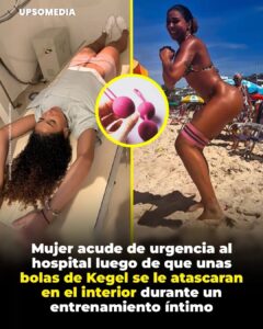 Una mujer influencer brasileña de 24 años llamada Emelly Souza acudió a un centro médico tras quedar varias bolas de ejercicio Kegel alojadas en su interior