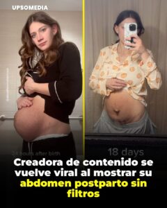 La usuaria @alexslifeinmotherhood se volvió viral tras compartir un honesto video de su abdomen después del parto.