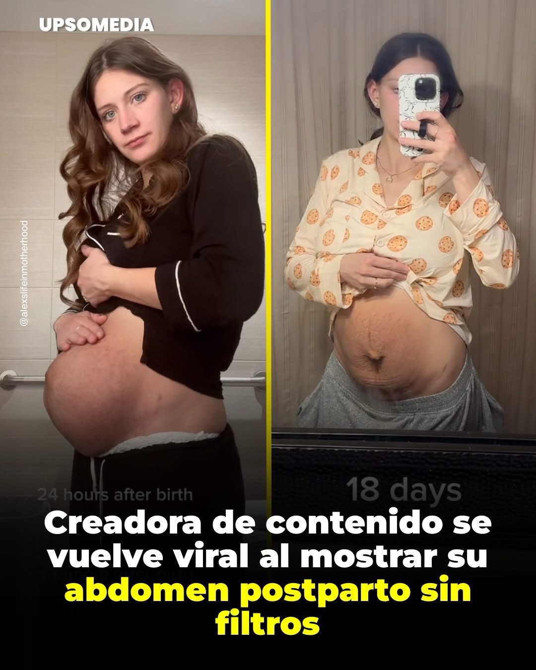 La usuaria @alexslifeinmotherhood se volvió viral tras compartir un honesto video de su abdomen después del parto.