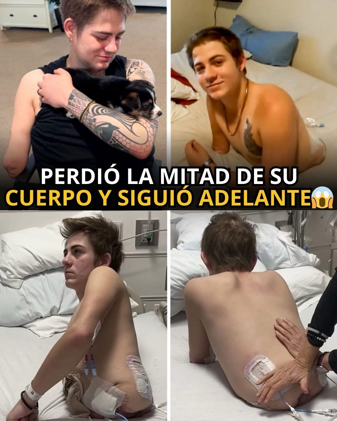 El accidente que cambió la vida de Loren Schauers