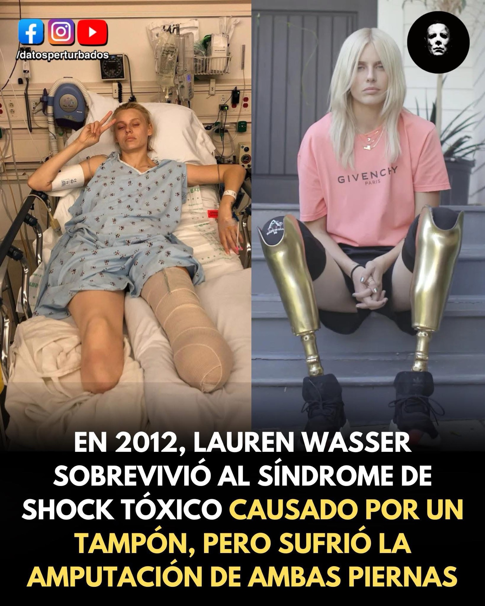 LAUREN WASSER: CUANDO UN TAMPÓN CASI LE CUESTA LA VIDA