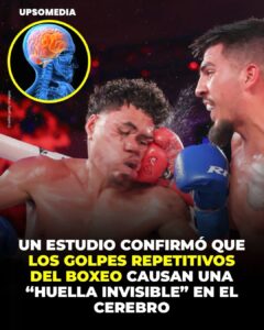 Un estudio de Irlanda reveló que los golpes repetidos en el boxeo pueden dejar una “huella invisible” en el cerebro