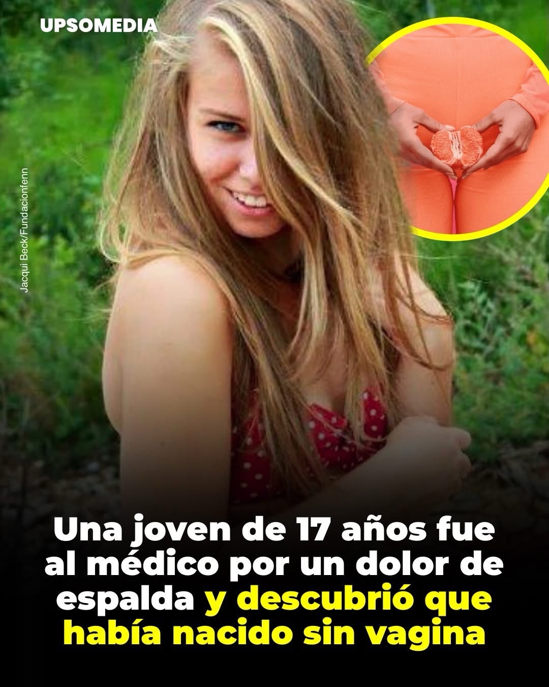 Había nacido con un extraño síndrome que le impidió desarrollar parte de su sistema reproductivo.