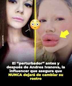 Andrea Ivanova, una influencer búlgara de 27 años, volvió a generar impacto por el drástico antes y después de su rostro