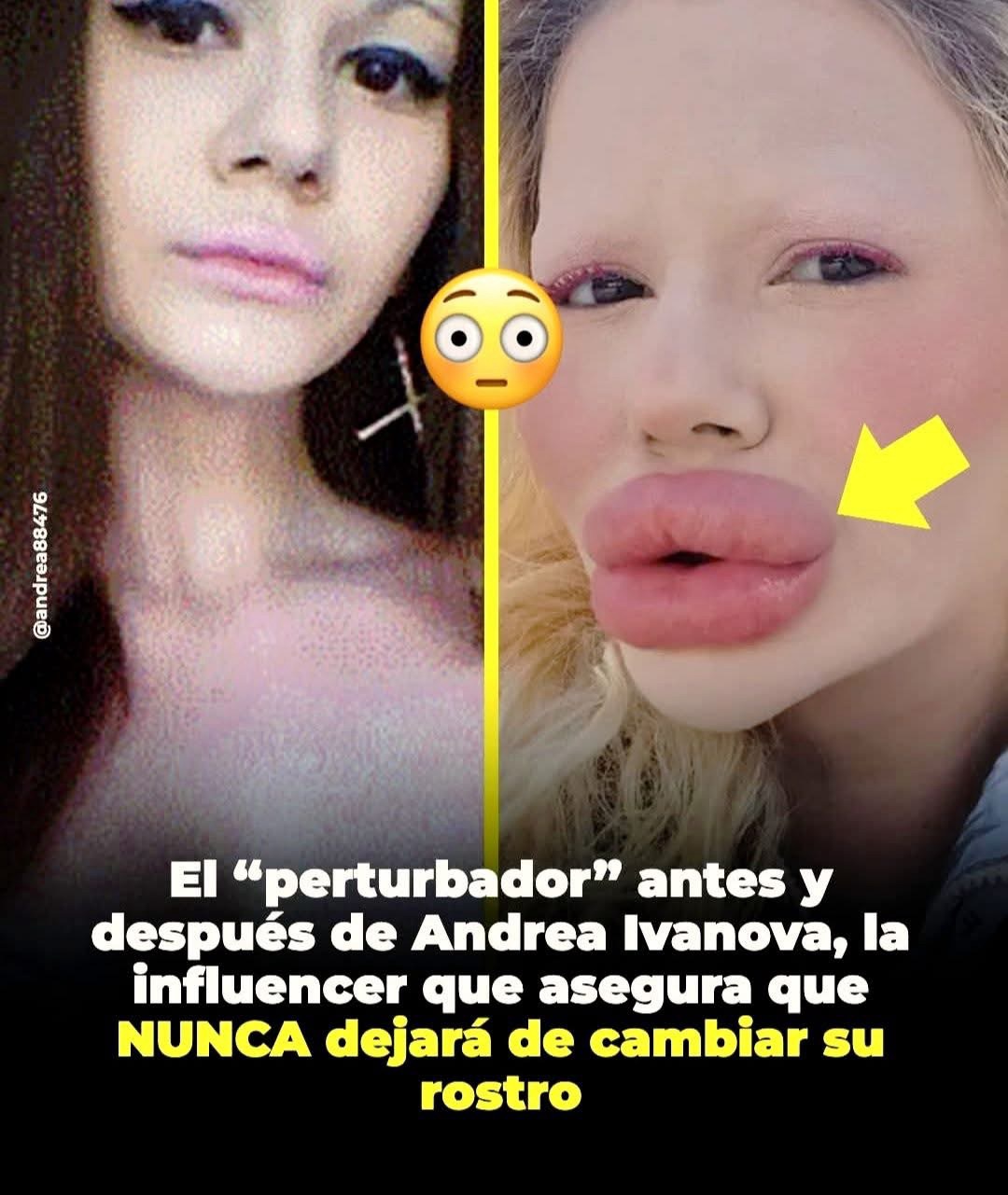 Andrea Ivanova, una influencer búlgara de 27 años, volvió a generar impacto por el drástico antes y después de su rostro
