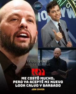 🗣️ “Bueno, empecé a optar por el look calvo y barbudo. Ya acepté mi calvicie”.