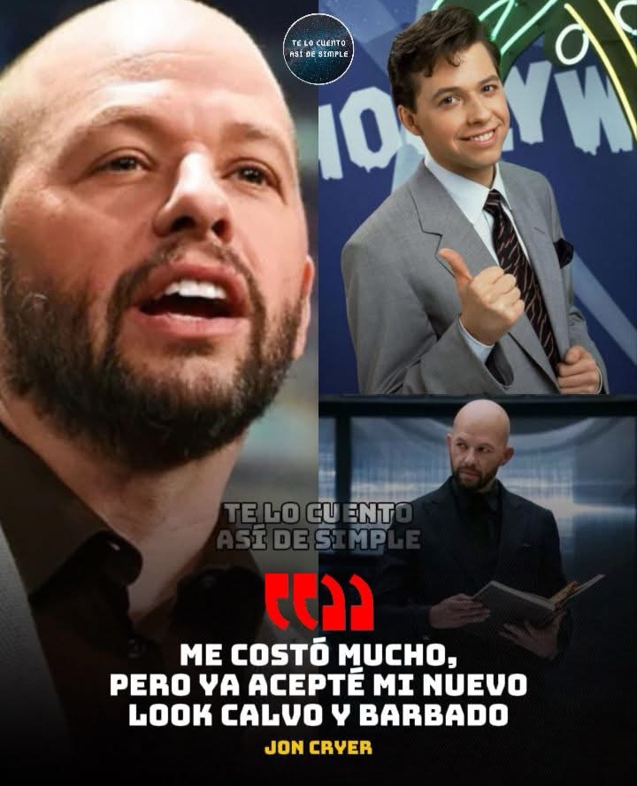 🗣️ “Bueno, empecé a optar por el look calvo y barbudo. Ya acepté mi calvicie”.