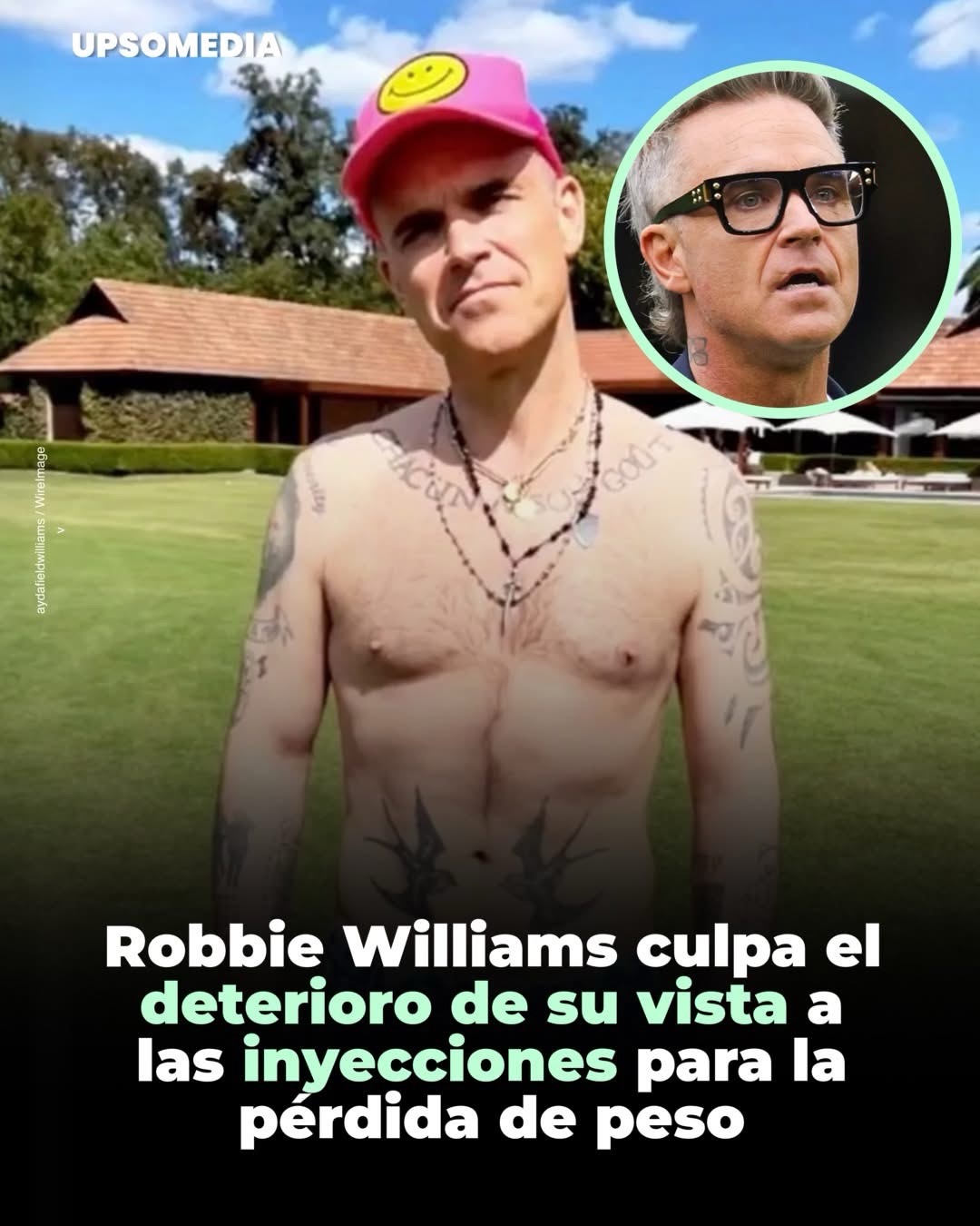 El cantante Robbie Williams, vinculó su alarmante deterioro visual con el uso de inyecciones para adelgazar.