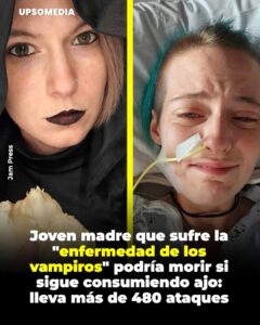 Esta afección, conocida históricamente como la enfermedad de los vampiros, impide que la paciente consuma alimentos con alto contenido de azufre como el ajo, ya que podría sufrir un ataque fatal