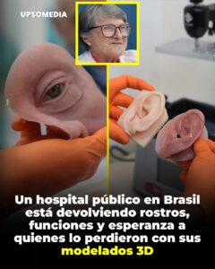 Un hospital público en Brasil está devolviendo rostros, funciones y esperanza a quienes lo perdieron con sus modelados 3D