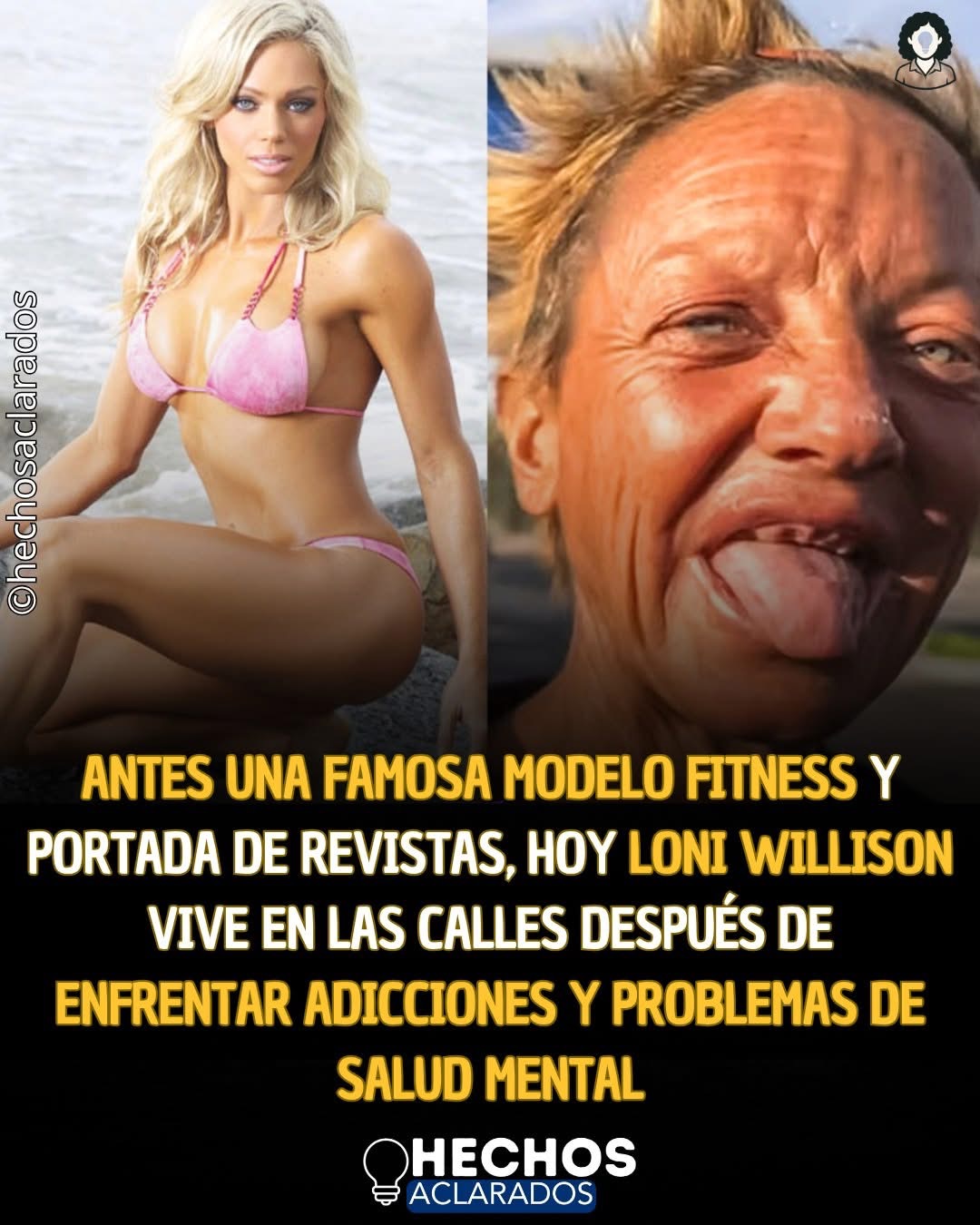 Loni Willison volvió a aparecer en los medios después de ser fotografiada viviendo en las calles de Los Ángeles