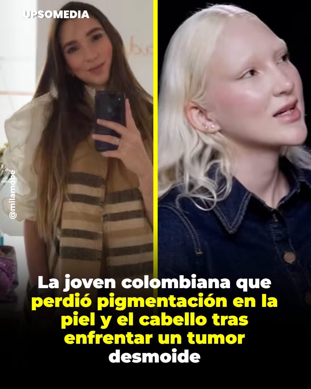 Un tumor desmoide que la llevó a cirugías, quimioterapia y un proceso que transformó su apariencia física.