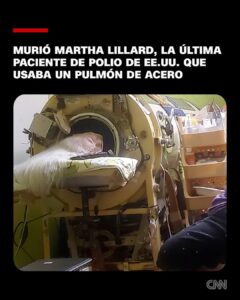 Lillard era la última paciente de polio de EE.UU.